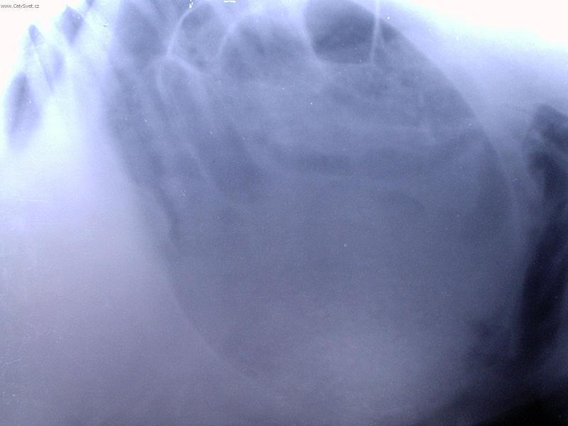 Foto: Chirurgie m�kk�ch tk�n�