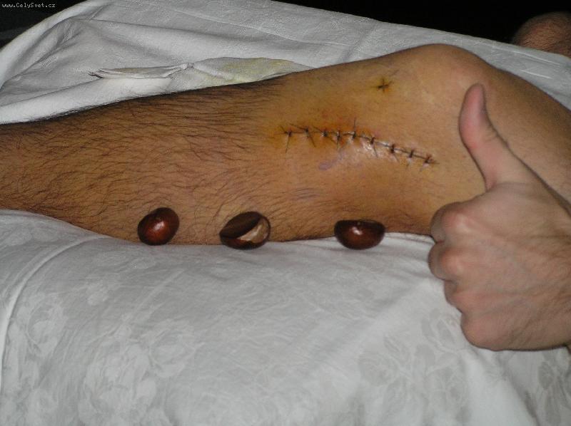 Foto: z�ti�� s jizvou a ka�tany